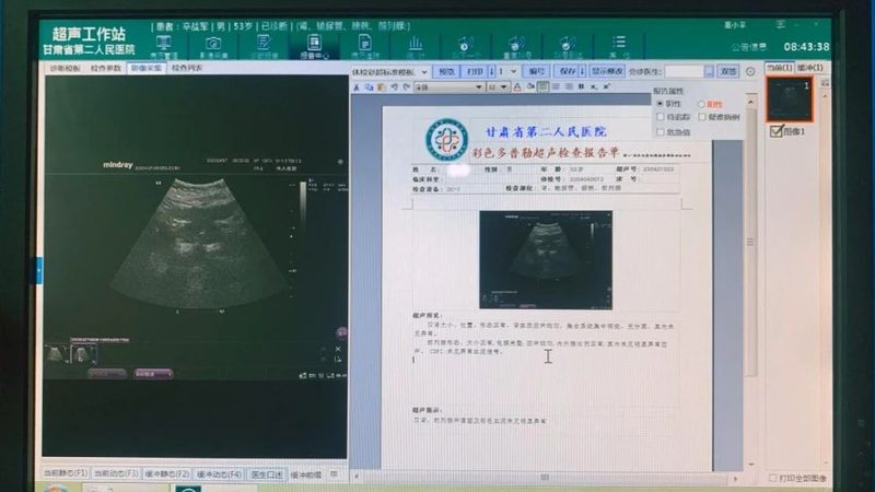 体检预约套餐到底含什么